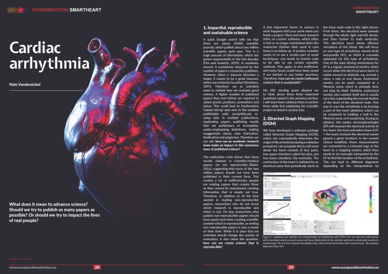 Cardiac arrhythmia