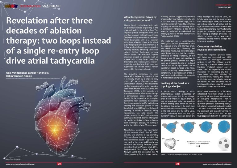 Revelation after three decades of ablation therapy: two loops instead of a single re-entry loop drive atrial tachycardia